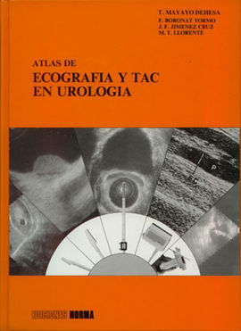 ATLAS DE ECOGRAFIA Y TAC EN UROLOGIA