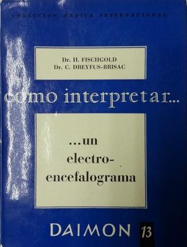 COMO INTERPRETAR... UN ELECTRO-ENCEFALOGRAMA.